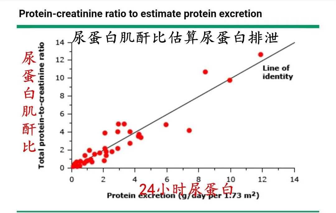 代替24小时尿蛋白的化验，ACR和PCR了解一下